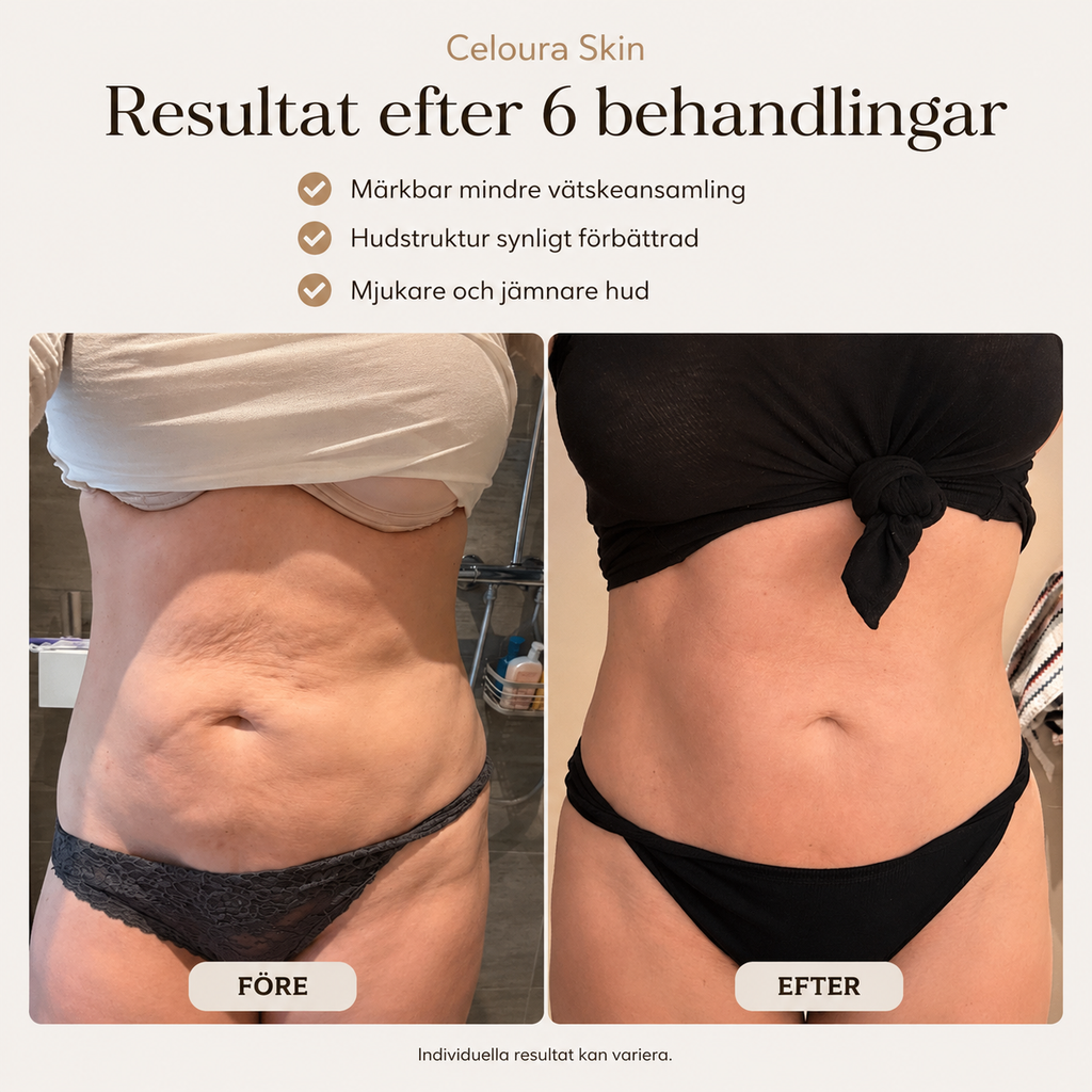 Celoura SkinPro